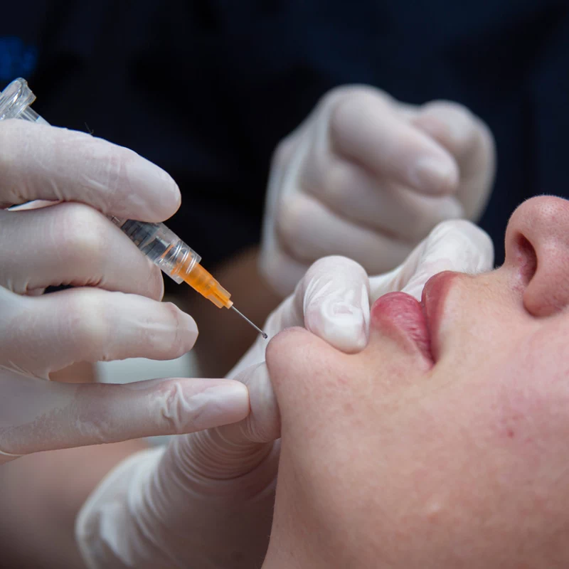 Филлеры на базе гиалуроновой кислоты