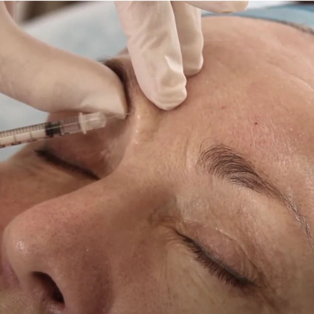 Ботулинический нейропротеин