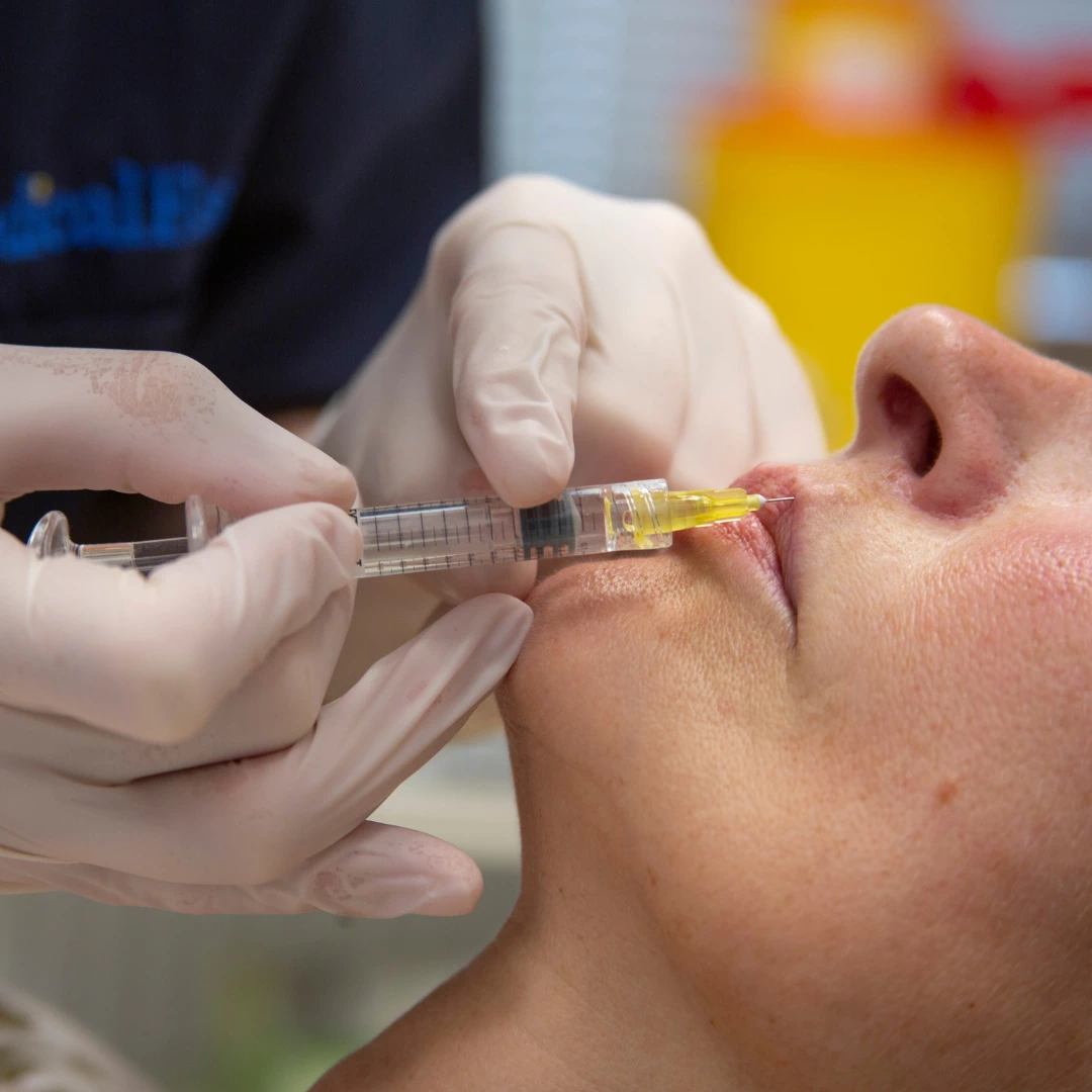 Как избежать осложнений при работе косметолога с губами